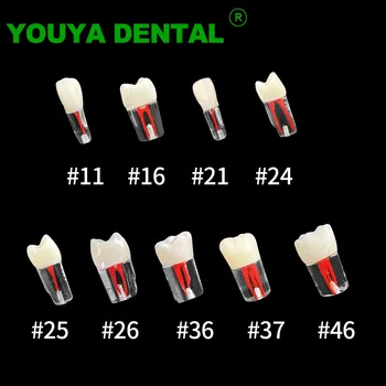 10vnt Dantų Dantų Modelį, Endodontinis Šaknų Kanalų Bendrosios Praktikos Dantų Pulpos Ertmę Studijų Modelį RCT Praktikos Endo Mokymo Odontologija